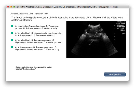 OB Anesthesia quiz image